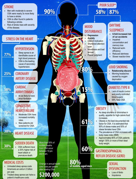 not-getting-sleep-infographic