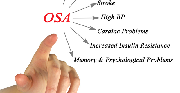 Obstructive Sleep Apnea