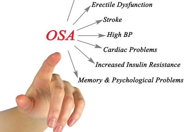 Obstructive Sleep Apnea